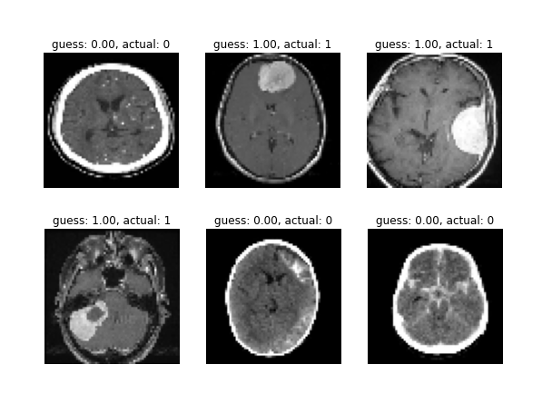 brain_mri_classifier thumbnail